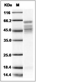 Human respiratory syncytial virus (RSV) Fusion protein/RSV-F (Strain RSS-2) Protein (His)