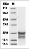 FGF-16 Protein, Human, Cynomolgus, Recombinant