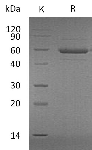 APRIL/TNFSF13 Protein, Human, Recombinant (Flag & His)