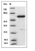 PHGDH Protein, Human, Recombinant (His)