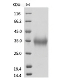 CD47 Protein, Human, Recombinant