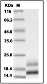 VEGF121b Protein, Human, Recombinant