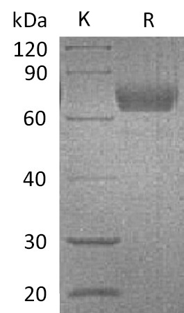 IL-4R alpha Protein, Mouse, Recombinant (hFc)