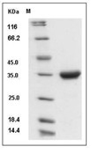 IgG4 Protein, Human, Recombinant (S108P)