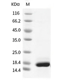 IL-21 Protein, Human, Recombinant