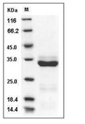 PRSS3 Protein, Human, Recombinant (His)