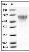 TREML2 Protein, Human, Recombinant (His)