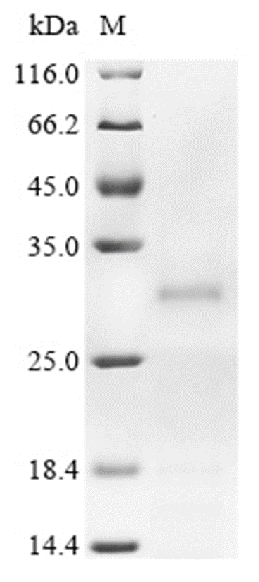 RAC1 Protein, Human, Recombinant (His)