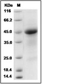 R-Spondin 1/RSPO1 Protein, Mouse, Recombinant (His)