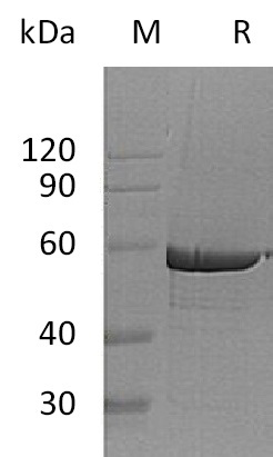 G6PD Protein, Human, Recombinant (His)