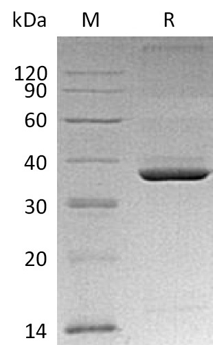 Apolipoprotein E/APOE Protein, Mouse, Recombinant (His)