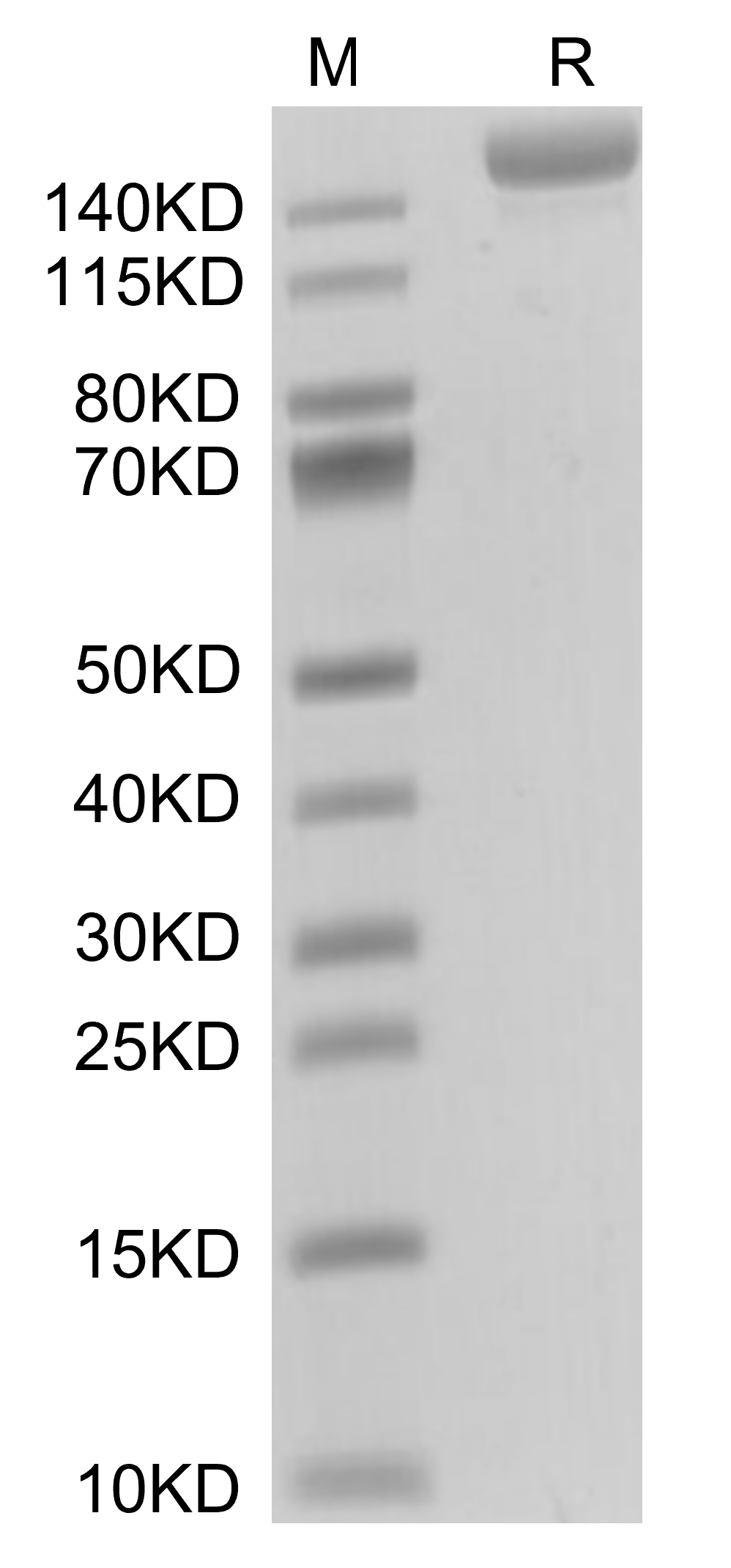 L1CAM Protein, Mouse, Recombinant (His)