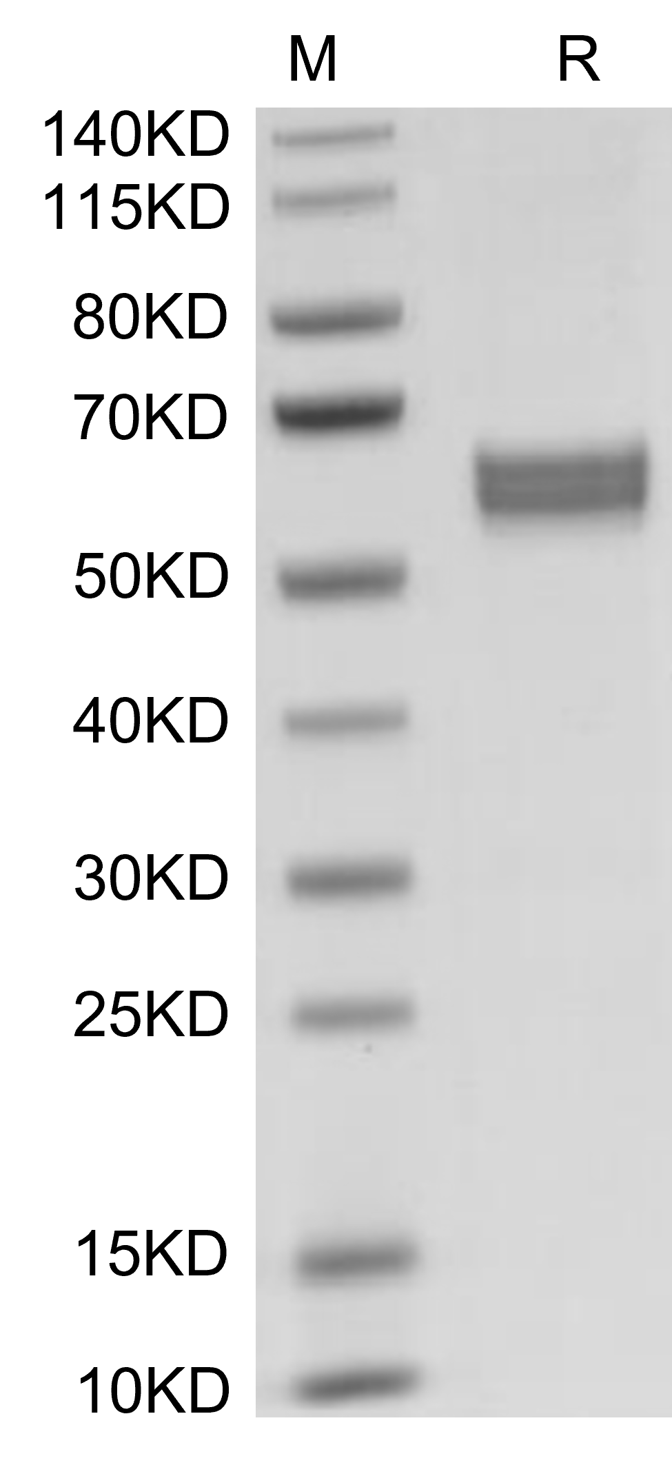 HGF Protein, Human, Recombinant (hFc)