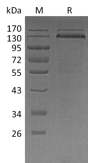 THBS1 Protein, Human, Recombinant (His)