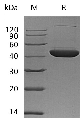 DHS Protein, Human, Recombinant (His)