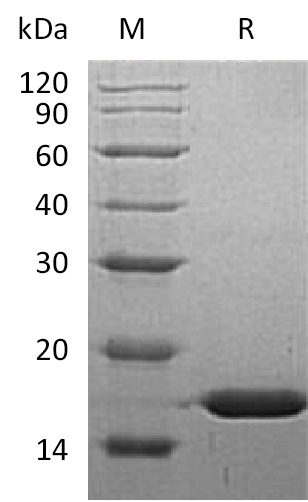 FABP5 Protein, Human, Recombinant (His)