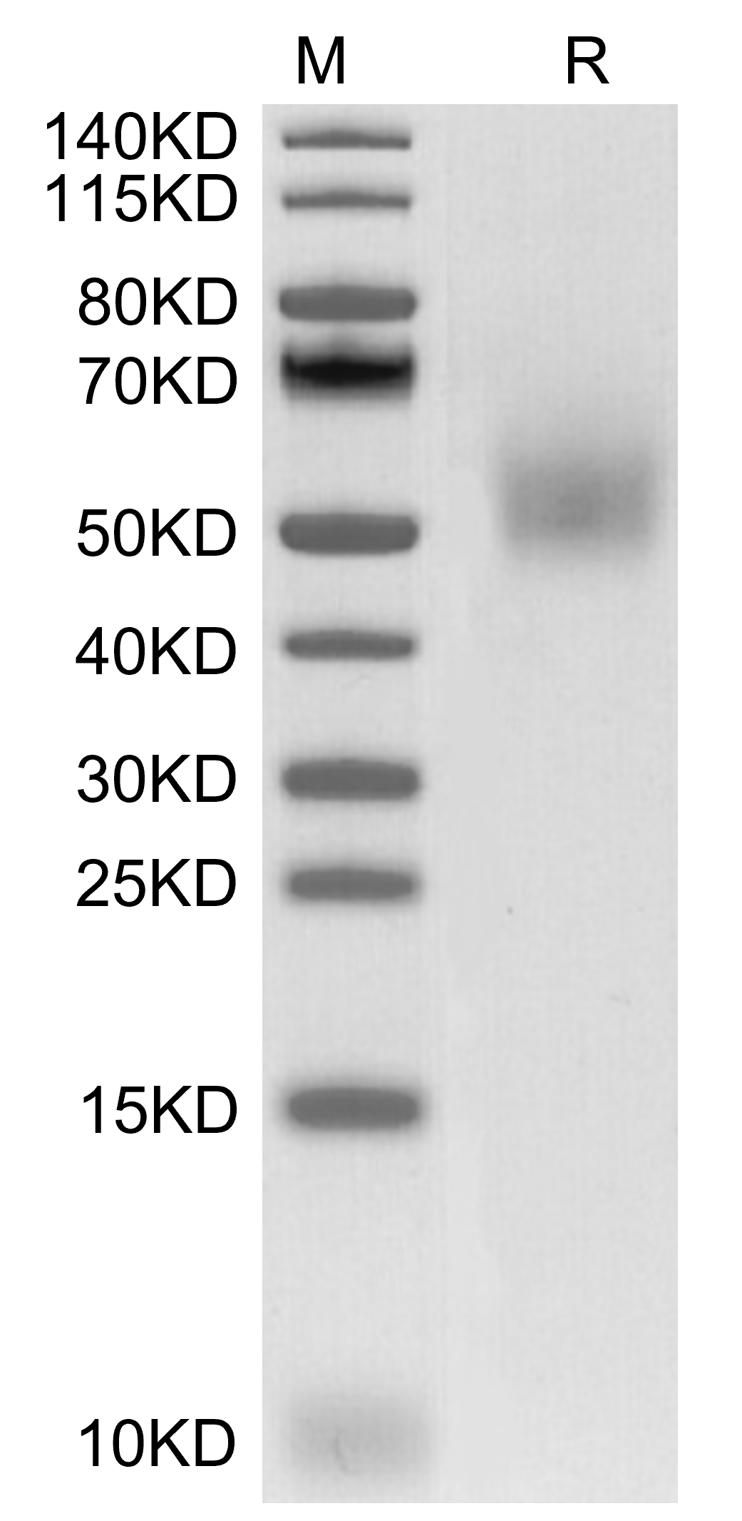 DLK1 Protein, Mouse, Recombinant (His)