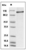 STAT6 Protein, Human, Recombinant (His)