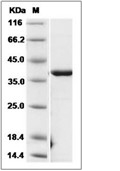 CSNK2A2 Protein, Human, Recombinant