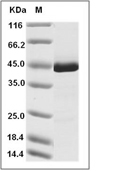 GCDH Protein, Human, Recombinant (His)