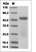 IL-17B Protein, Human, Recombinant (hFc)