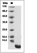 CCL18 Protein, Human, Recombinant (His)