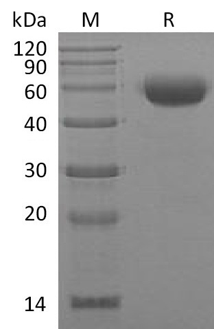 IL-22 Protein, Mouse, Recombinant (mFc)