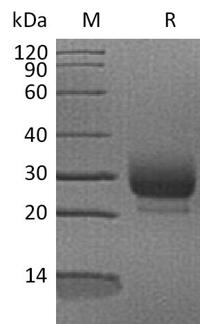 RNASE3 Protein, Human, Recombinant (His)