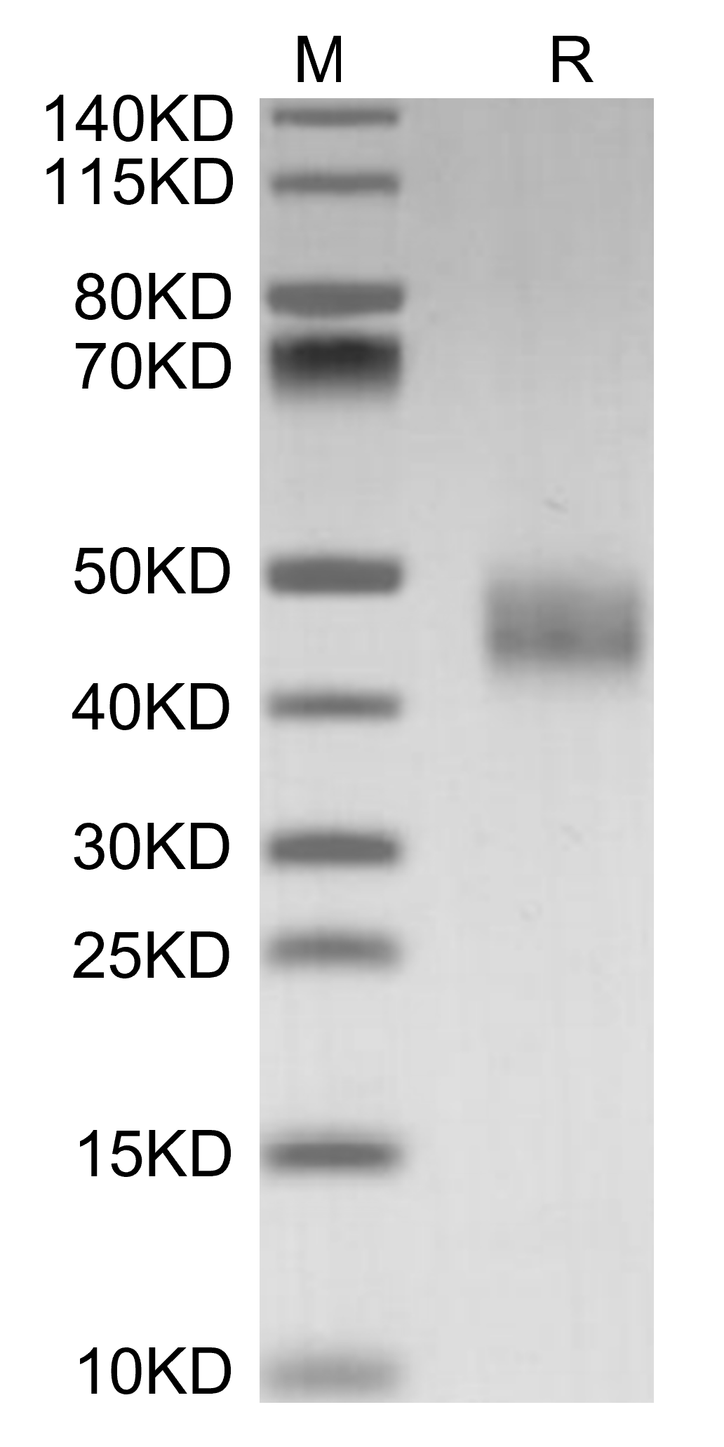 Galectin-3 Protein, Mouse, Recombinant (His)