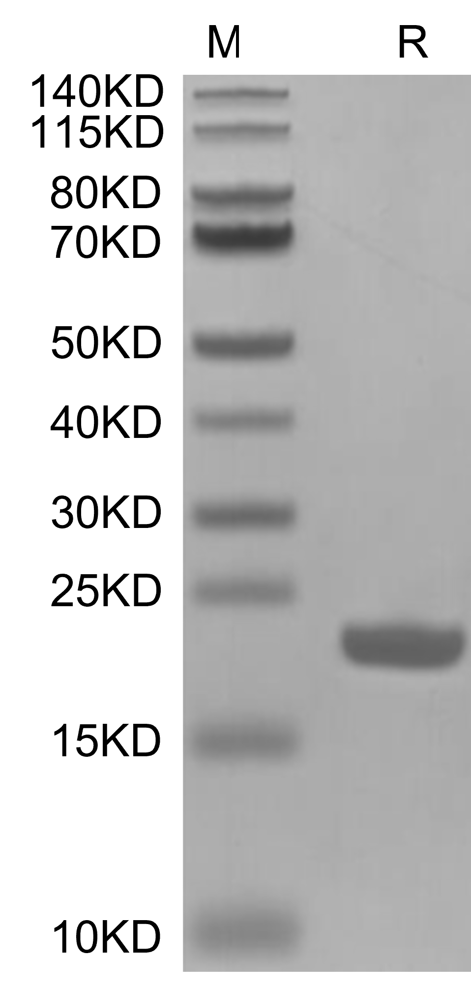 IL-1 beta/IL-1F2 Protein, Human, Recombinant (His & Avi)