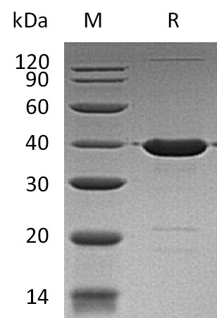 GABARAP Protein, Human, Recombinant (GST)