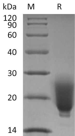 Irisin Protein, Human/Mouse/Rat, Recombinant (N-His)