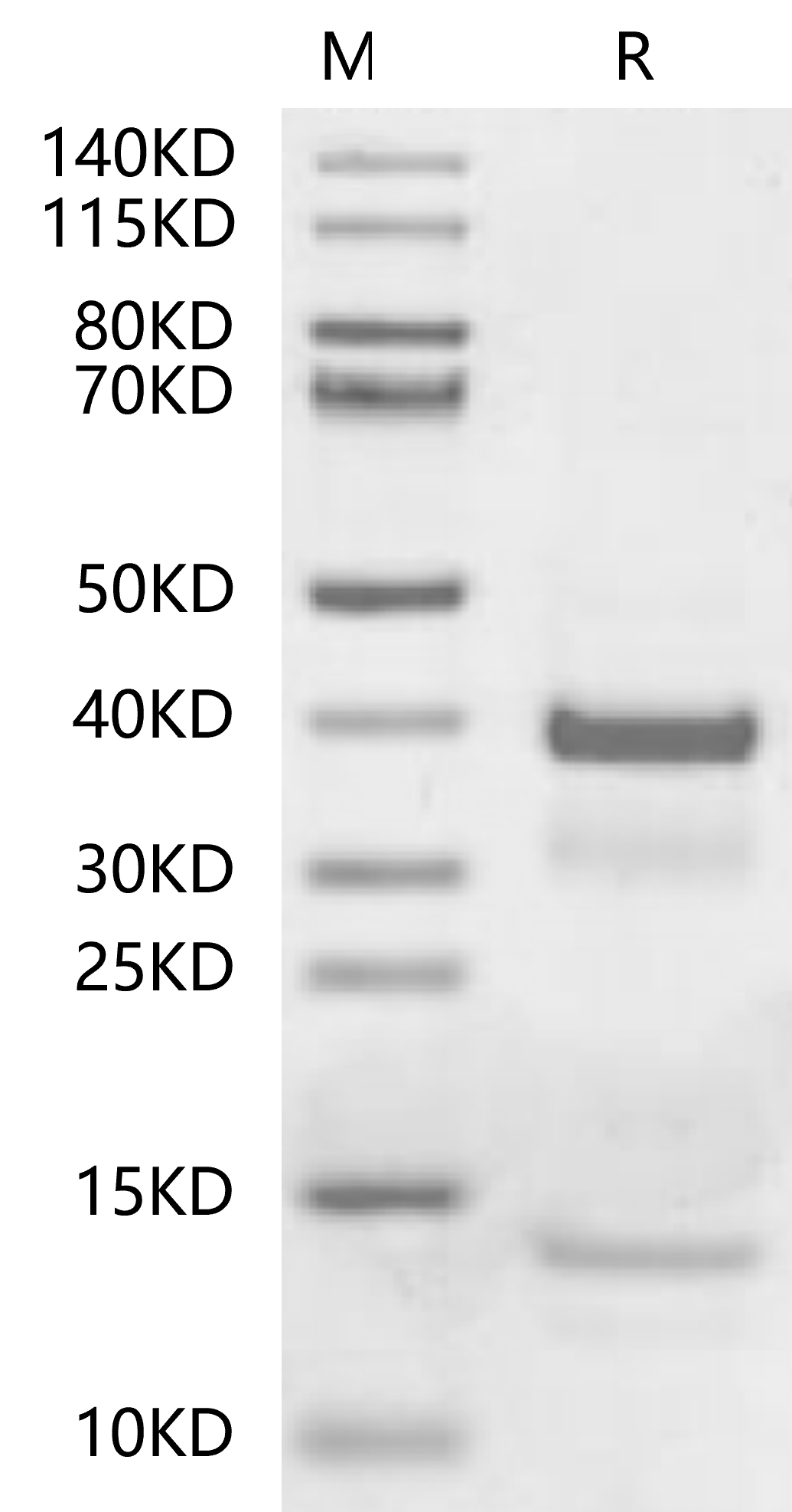 tPA Protein, Mouse, Recombinant (His)