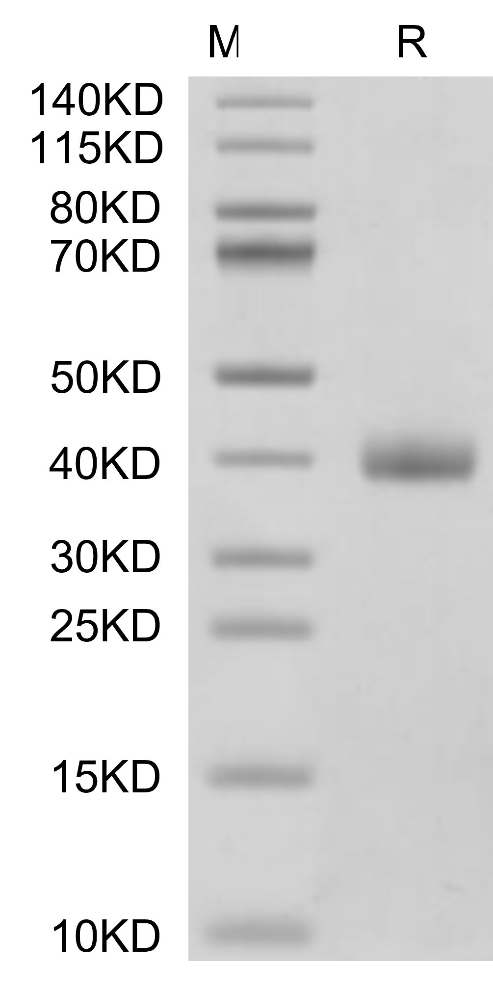 IL-22RA1 Protein, Cynomolgus, Recombinant (His)