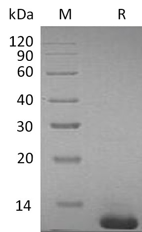 S100B Protein, Mouse, Recombinant (His)