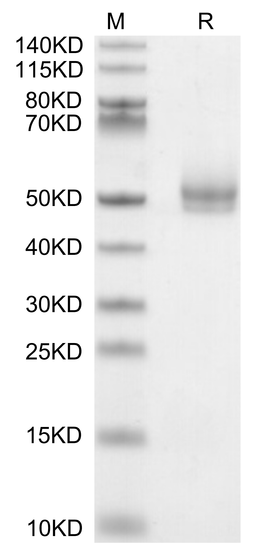 TGFBR1 Protein, Human, Recombinant (mFc & Avi)