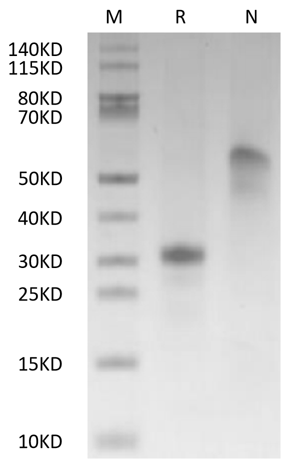 VEGF165 Protein, Human, Recombinant (His & Avi)