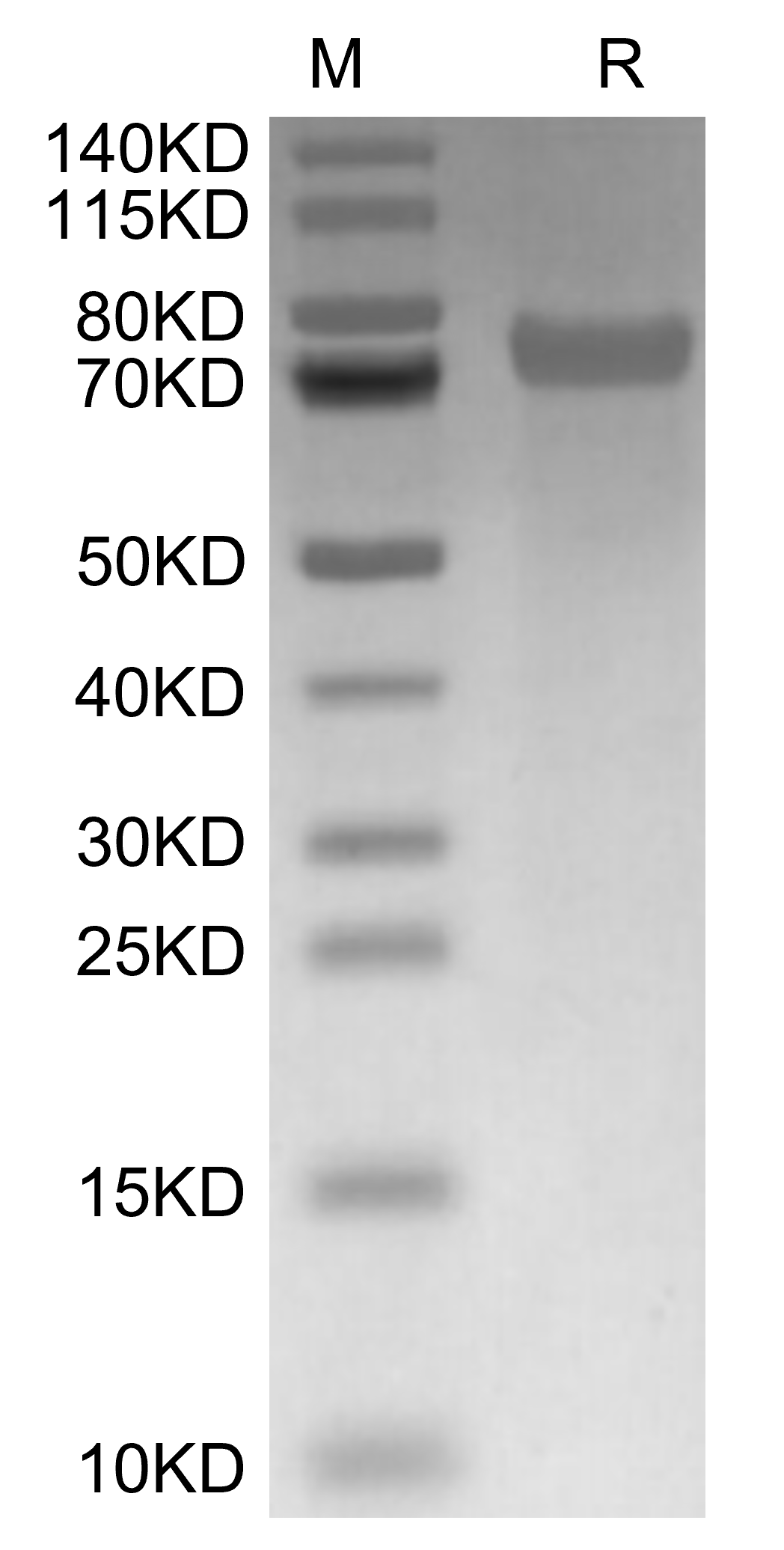 Tenascin Protein, Mouse, Recombinant (His)