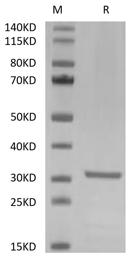 PLAU/uPA Protein, Mouse, Recombinant (His & Avi)