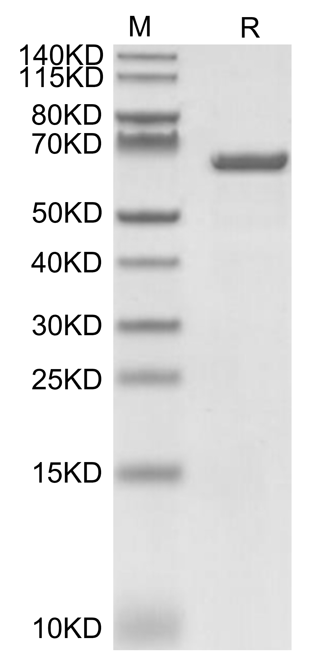 Serum Albumin Protein, Human, Recombinant (His & Avi)