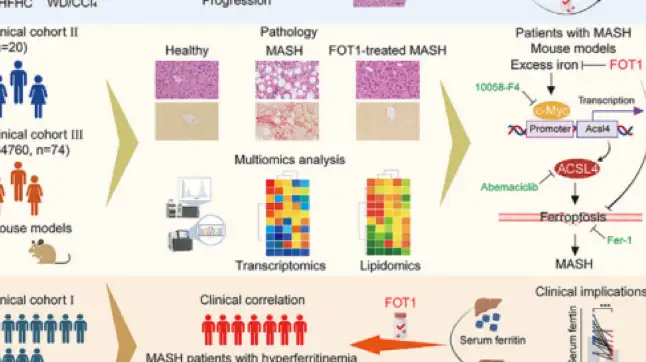脂肪肝新药？铁死亡螯合剂FOT1可有效抑制MASH进展