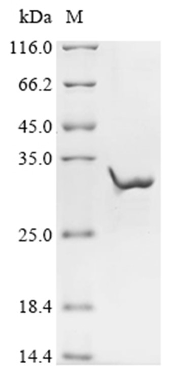 CHRNE Protein, Human, Recombinant (His & Myc)