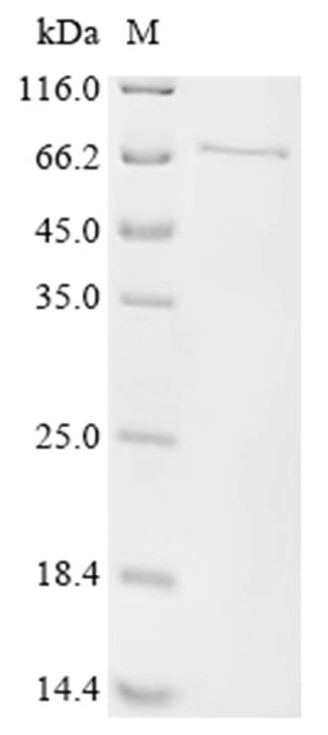 OGT Protein, Human, Recombinant (His & SUMO)